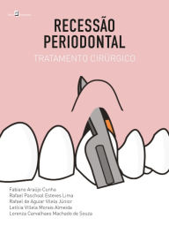 Title: Recessão Periodontal: Tratamento Cirúrgico, Author: Rafael Paschoal Esteves Lima