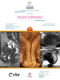 Title: Pelve Feminina - Volume 11: Coleção CBR Radiologia e Diagnóstico por Imagem, Author: Ronaldo Hueb Baroni