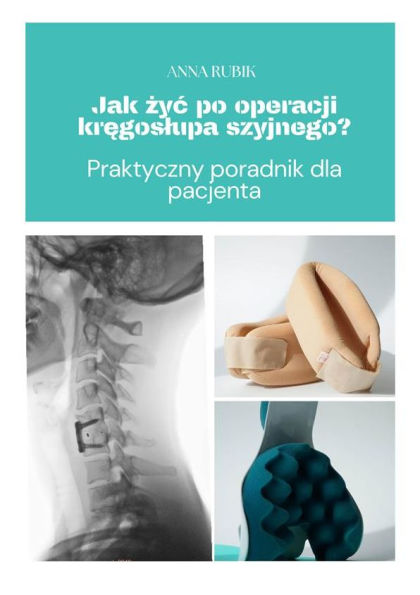 Jak zyc po operacji kregoslupa szyjnego?: Praktyczny poradnik dla pacjenta
