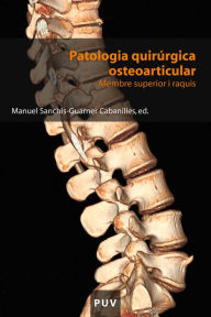 Title: Patologia quirúrgica osteoarticular: Membre superior i raquis, Author: AAVV