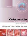 Colposcopia. Principios y práctica: Manual y atlas integrados