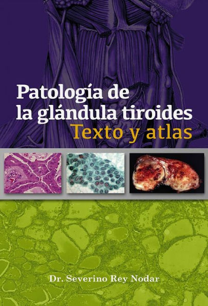 Patolog a de la gl ndula tiroides: Texto y atlas