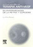 Alternative view 2 of Actualización de Terapia Anti-VEGF en enfermedades de la retina y coroides