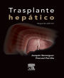 Trasplante hepático