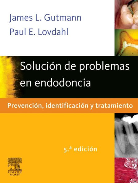 Solución de problemas en endodoncia: Prevención, identificación y tratamiento