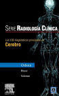Serie Pocket de Radiologia: Los 100 diagnosticos principales en cerebro