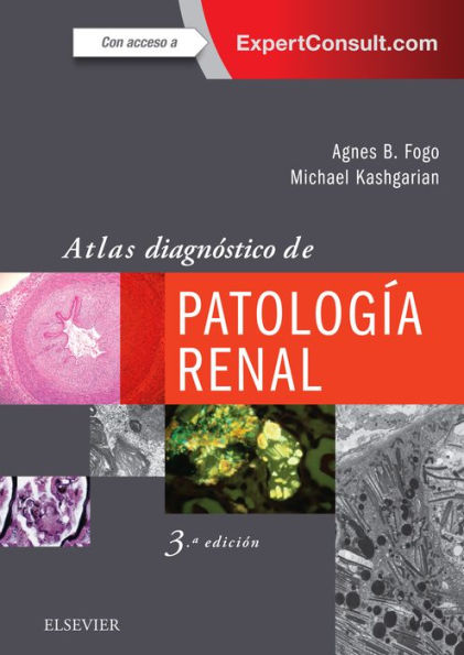 Atlas diagnóstico de patología renal