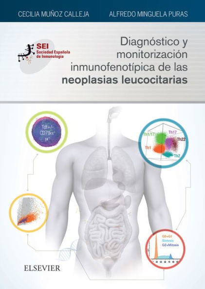 Diagnóstico y monitorización inmunofenotípica de las neoplasias leucocitarias: Sociedad Española de Inmunología