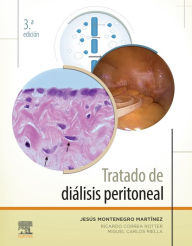 Title: Tratado de diálisis peritoneal, Author: Jesús Montenegro Martínez