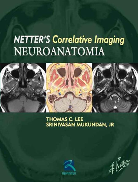 Neuroanatomia: Netter's correlative imaging