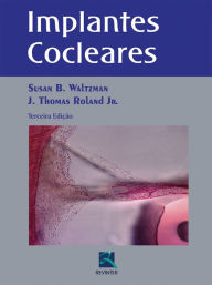 Title: Implantes cocleares, Author: Susan B. Waltzman