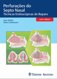 Title: Perfurações do Septo Nasal: Técnicas Endoscópicas de Reparo, Author: Isam Alobid