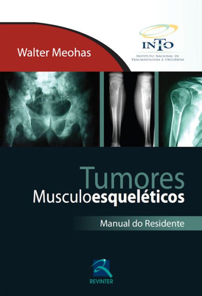 Tumores Musculoesqueléticos: Manual do Residente
