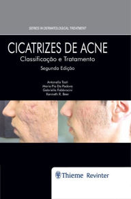 Title: Cicatrizes de Acne: Classificação e Tratamento, Author: Antonella Tosti