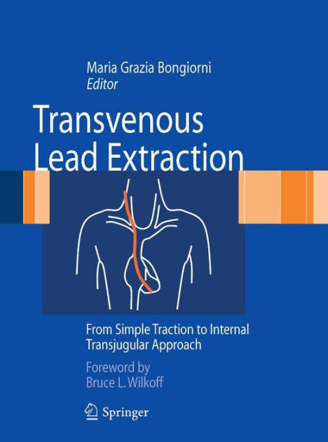 Transvenous Lead Extraction: From Simple Traction to Internal Transjugular Approach [ペーパーバック] Bongiorni， Maria Grazia Transvenous Lead Extraction: From Simple Traction to