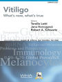 Vitiligo: What's New, What's True