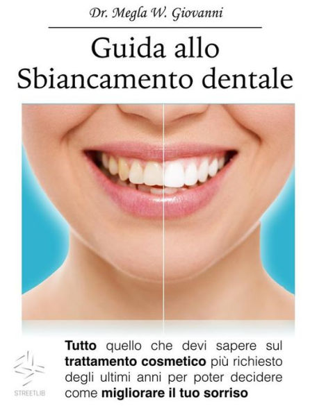 Guida allo Sbiancamento Dentale