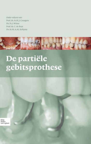 De partiï¿½le gebitsprothese: uitgangspunten bij de diagnostiek en behandeling van het gemutileerde gebit