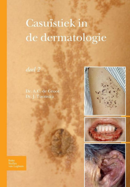 Casuïstiek in de dermatologie - deel 2