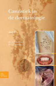 Title: Casuïstiek in de dermatologie - deel 2, Author: Johan Toonstra