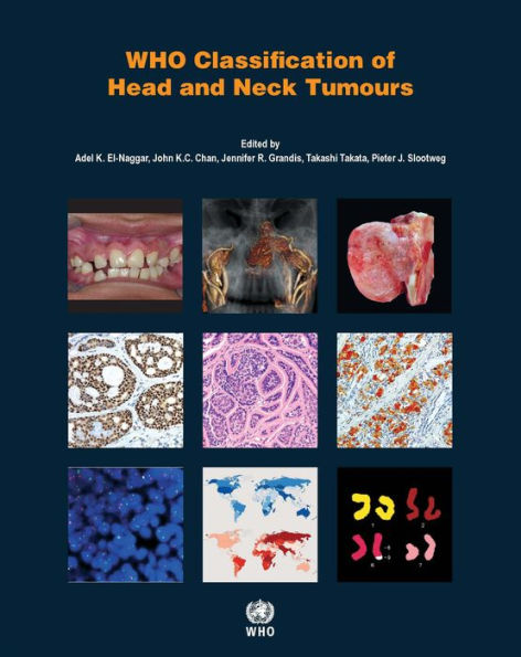 WHO Classification of Head and Neck Tumours / Edition 4