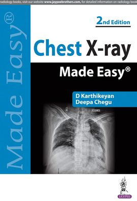 Chest X-ray Made Easy