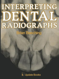 Title: Interpreting Dental Radiographs, Author: B.W. Beeching
