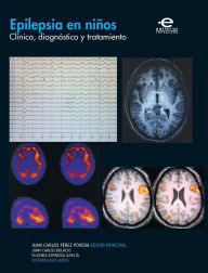 Title: Epilepsia en niños: Clínica, diagnóstico y tratamiento, Author: varios Autores