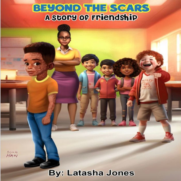 Beyond the Scars A story of Friendship by Latasha Jones, Paperback