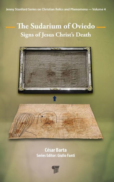 The Sudarium of Oviedo: Signs of Jesus Christ's Death