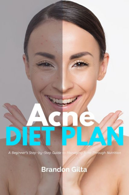 Acne Diet Plan A Beginners Step By Step Guide To Managing Acne Through Nutrition With Curated