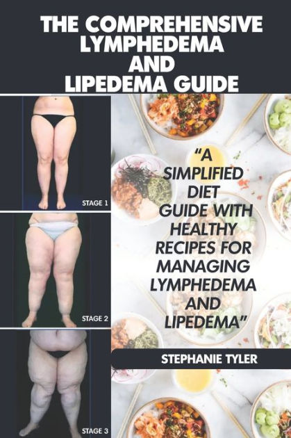 The Comprehensive Lymphedema And Lipedema Guide The Comprehensive