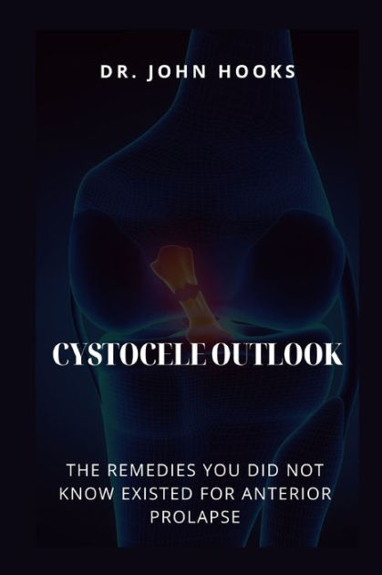 CYSTOCELE OUTLOOK: THE REMEDIES YOU DID NOT KNOW EXISTED FOR ANTERIOR  PROLAPSE by DR. JOHN HOOKS, Paperback