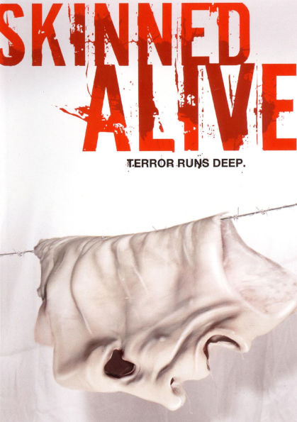 Skinned Alive