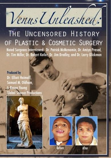 Venus Unleashed: The Uncensored History of Plastic & Cosmetic Surgery