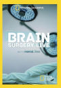 Brain Surgery Live with Mental Floss