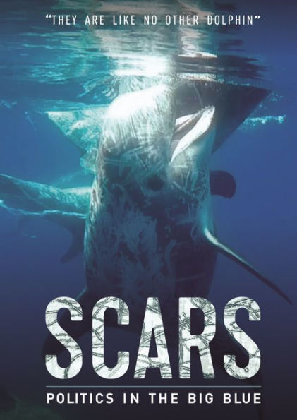 Scars