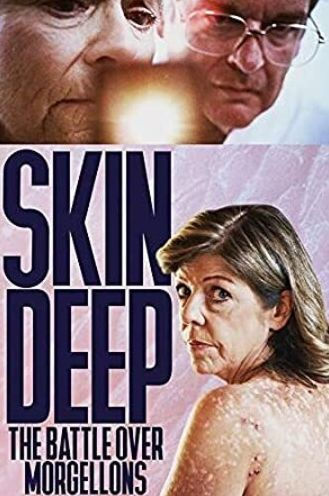 Skin Deep: The Battle Over Morgellons