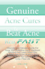 Genuine Acne Cures To Beat Acne Real Fast: Discover The Genuine Cures For Acne With Definitive Acne Treatment Reviews And Learn What Skin Experts Say About Fighting Acne Real Fast So You Can Enjoy An Acne- Free Life