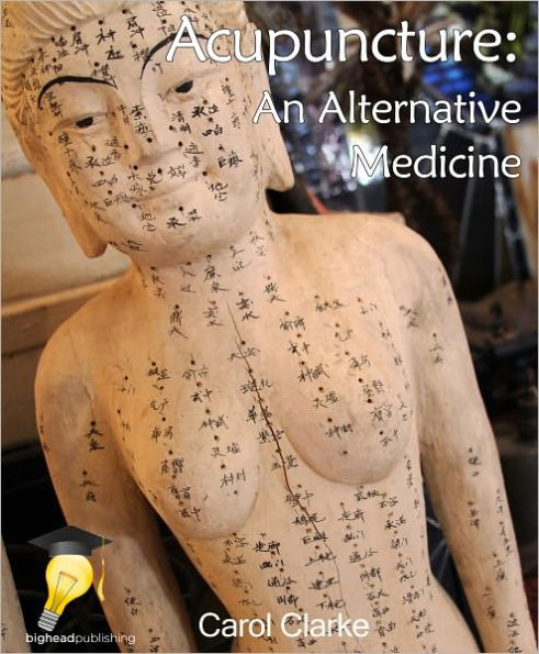 Acupuncture: An Alternative Medicine