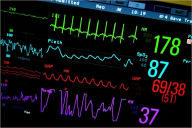 Title: Heart Disease: Not Something to Ignore. Understand the Causes, Treatments, & Prevention, Author: Strong Heart