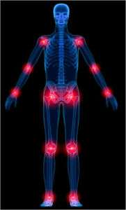 Title: Arthritis: Diagnosis and Treatment Options including Natural Pain Remedies, Author: David Durban
