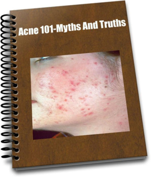 Acne 101-Myths And Truths