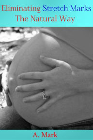 Title: Eliminating Stretch Marks The Natural Way, Author: A. Mark