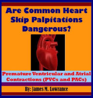 Title: Are Common Heart Skip Palpitations Dangerous?, Author: James Lowrance