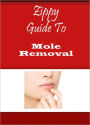 Zippy Guide To Mole Removal