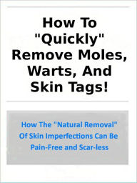 Title: How To Quickly Remove Moles, Warts, and Skin Tags;How The 