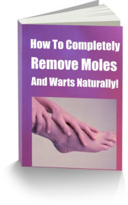 Title: Wart-Mole-Tag Removal The Easy Way, Author: Sandy Hall