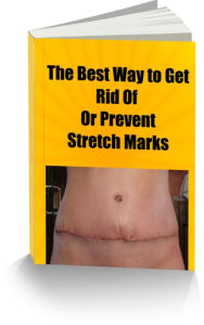 Title: The Best Way to Get Rid Of Or Prevent Stretch Marks, Author: Sandy Hall