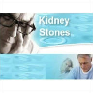 Title: 51 Tips for Dealing Kidney Stones - How to Prevent and Treat Kidney Stones, Author: eBook Legend